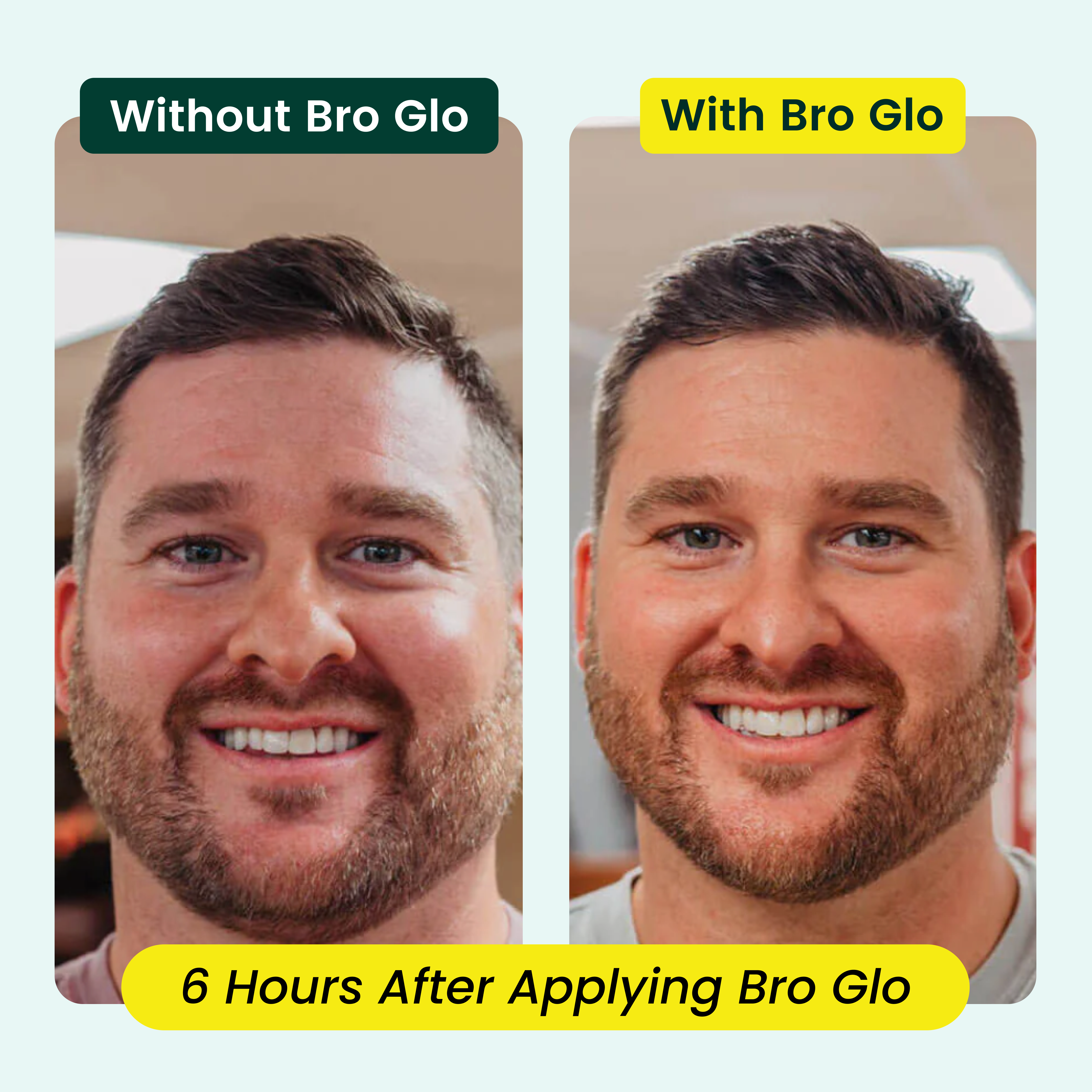 Man's face showing darker, more bronzed skin tone on right compared to left side.