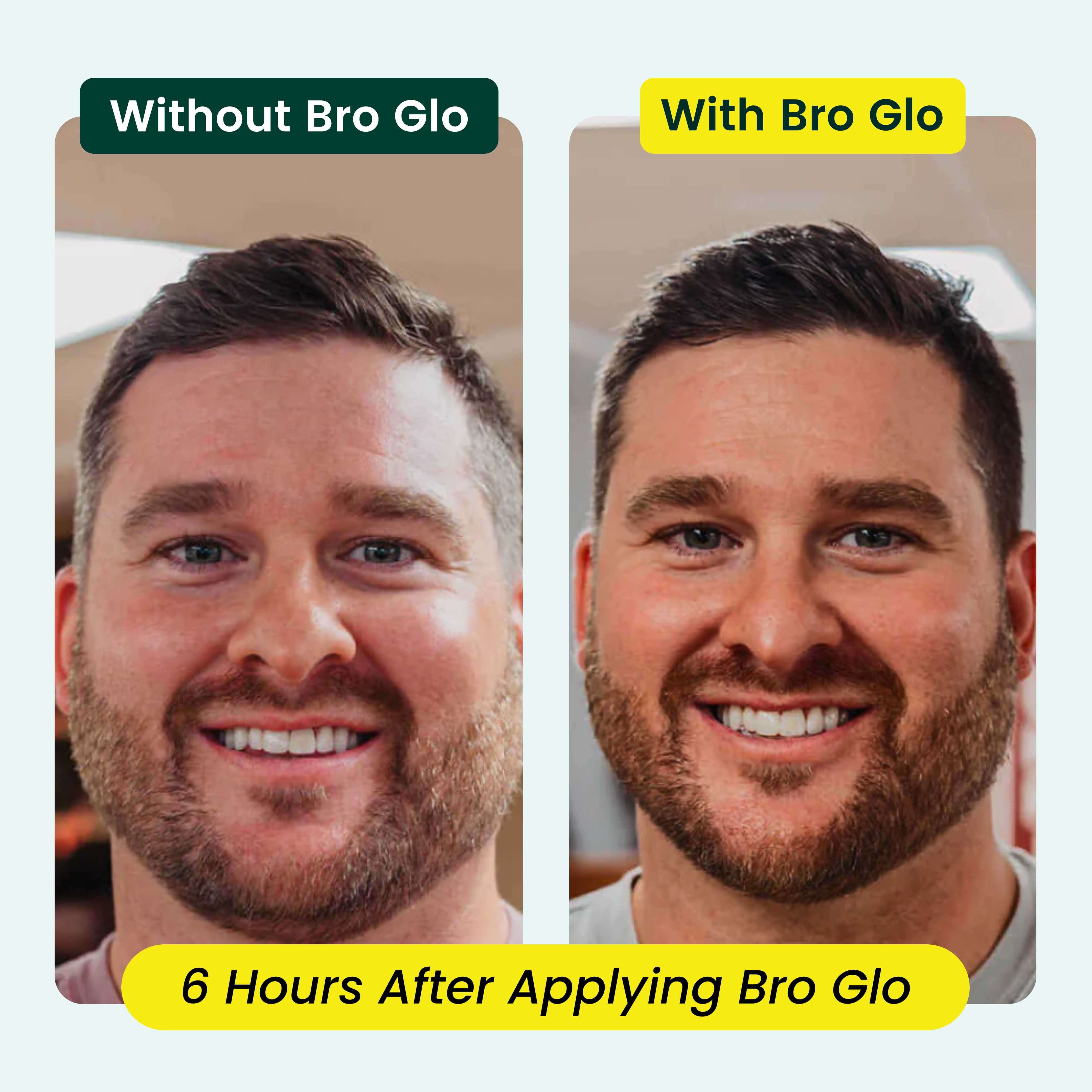 Man's face showing before and after complexion comparison, with improved skin tone and appearance on right side.