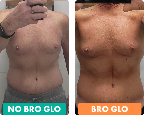 Bro Glo before and after result 2