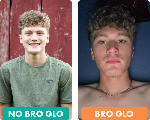 Bro Glo before and after result 3